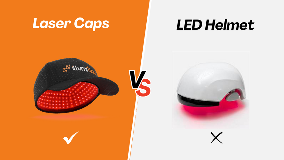 Laser Caps vs. LED Helmets: What the Clinical Data Really Shows