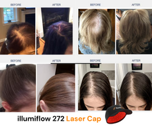 Load image into Gallery viewer, illumiflow 272 Pro Laser Cap - Loved By Women
