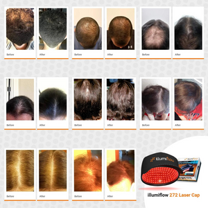 illumiflow 272 Laser Cap Bundle Laser Cap + DHT Blocking Vitamins + Hair Growth Guide (eBook)